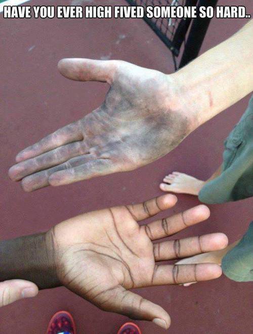 Have you ever high fived someone so hard..