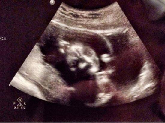 Looks like I’m having a kid! It might not be human though..