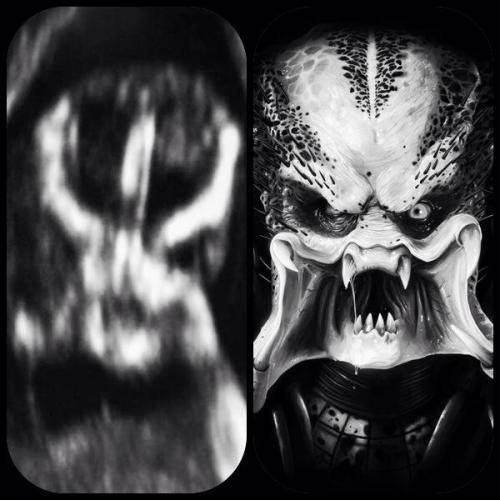 I sent my brother a picture of my baby scan, he sent me this...