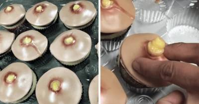 These Horrific Pimple Cupcakes Are The Nauseating Treat You Never Knew You Needed