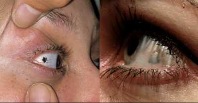 Eyeball Piercing Is 'The Latest Bizarre Fashion Trend' You Need To Know About