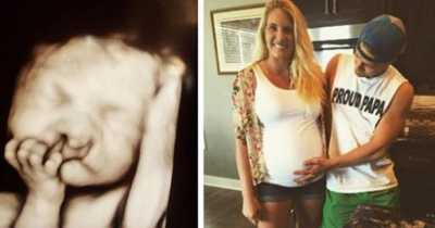 Parents Refuse To Abort Their Deformed Baby And Four Years Later He Is The Most Adorable Child