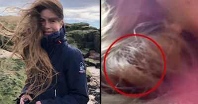 Woman Allows Abandoned Bird Nest To Live In Her Hair For 84 Days