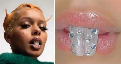 We Want To Know If The 'Squirrel Teeth' Trend Is A Joke In 2022