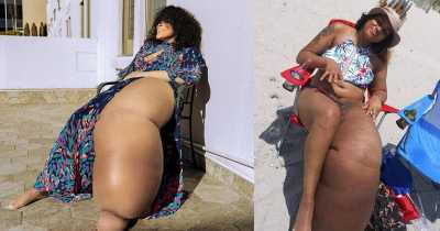 'People Troll Me For My 7 Stone Leg, But I’m Proud Of My Body'