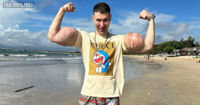 Notorious 'Russian Popeye' With 'Freak' Arms Flees Putin's Regime To Live In Bali