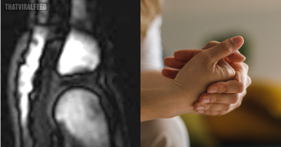 People Are Just Learning What Actually Happens When You Crack Your Knuckles