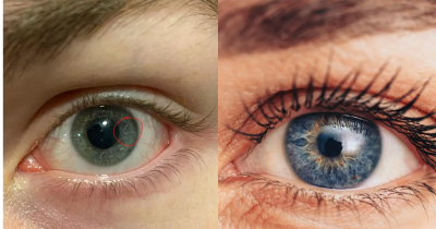 Woman Worried Her Boyfriend Is ‘Factory Made’ After Spotting Weird Detail Inside His Eye