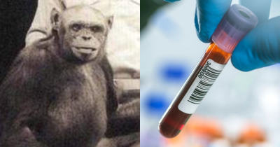 Scientists Created A 'Humanzee' In A Lab But Later Euthanized It Over Ethical Concerns