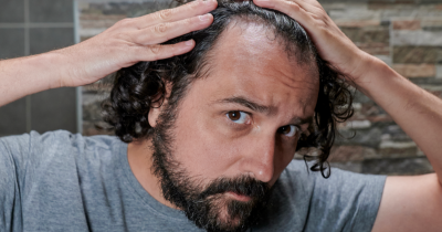 Doctor Warns That A Popular Drink May Lead To Hair Loss – And How To Prevent It