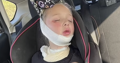 Parents Warn Others After Microwave Mistake Leaves 7-Year-Old In Coma With Severe Burns