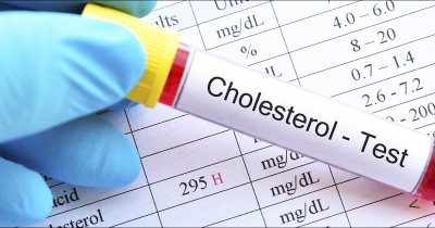 Natural Ways To Lower Cholesterol Without Using Medication