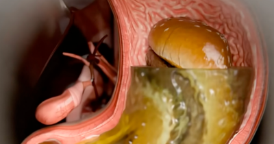 Simulation Reveals Shocking Truth About What Ozempic Does To Your Body After Injection