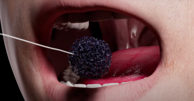 How A Simple Sponge Test Could Help Catch Deadly Cancer Early