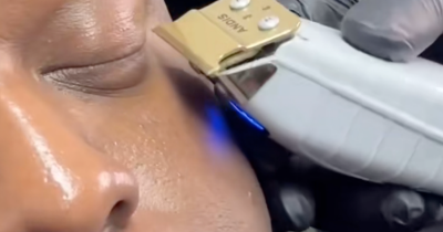 Experts Sound Alarm Over Risky New 'Manly' Eyelash Trend Gaining Popularity
