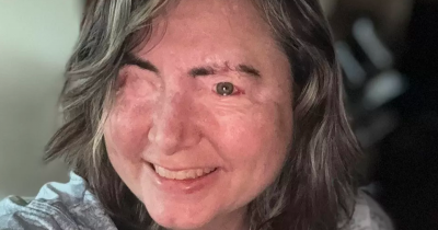 Woman Says She 'Left Her Body' As Abusive Husband Attacked Her With Chemicals