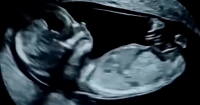 Amazing Footage Reveals What Babies Really Do In The Womb — And It's Blowing People's Minds